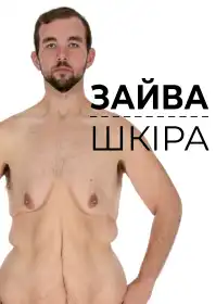 Зайва шкіра постер