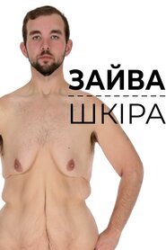 Зайва шкіра (2016)