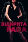 Відкрита рана