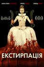 Екстирпація