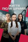 Життя після шрамів